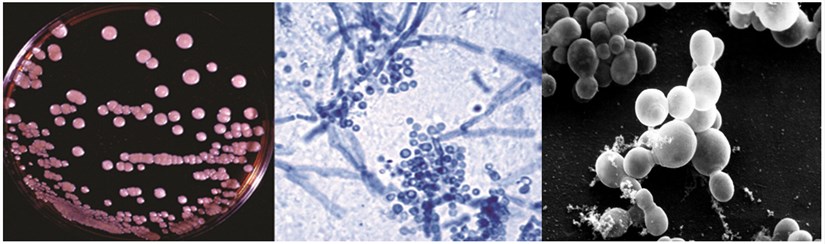 Causes de la dermite séborrhéique